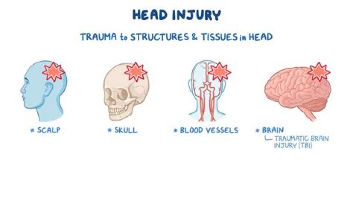 Uncovering The Risks Of Head Trauma In Boxers
